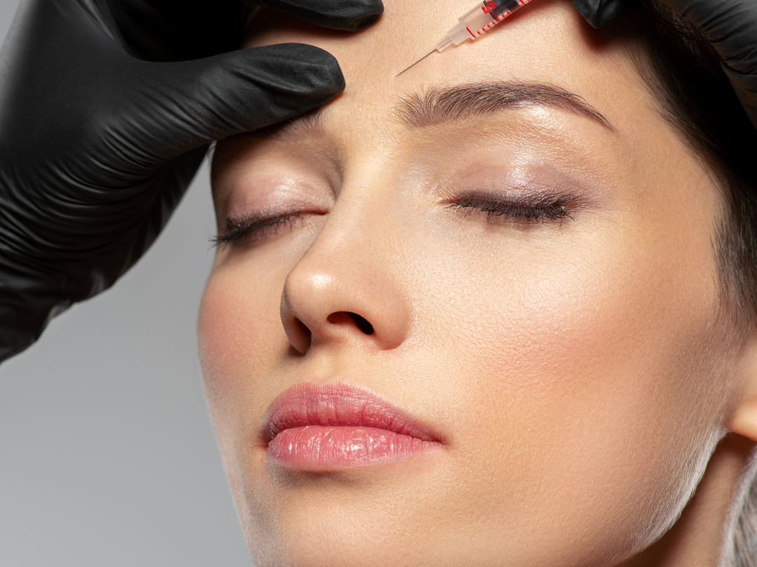 A picture of a clinician injecting botulinum toxin into a patients forehead